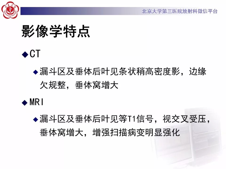 【病例】鞍区生殖细胞瘤1例CT及MR