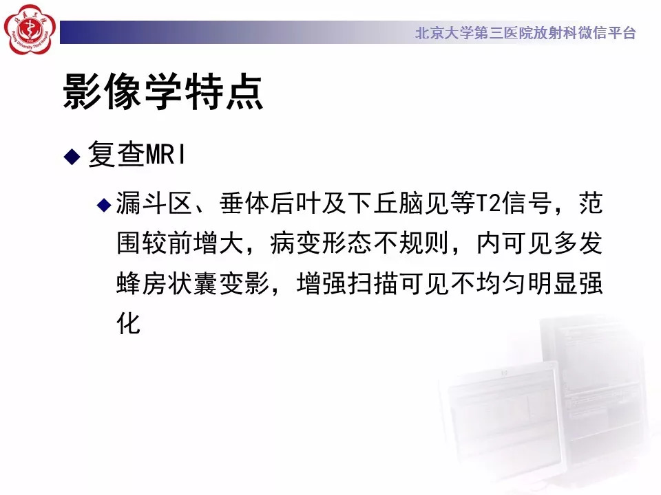 【病例】鞍区生殖细胞瘤1例CT及MR