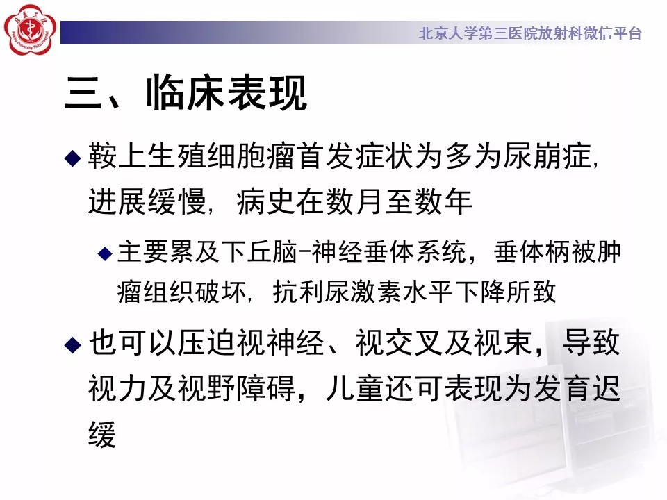 【病例】鞍区生殖细胞瘤1例CT及MR