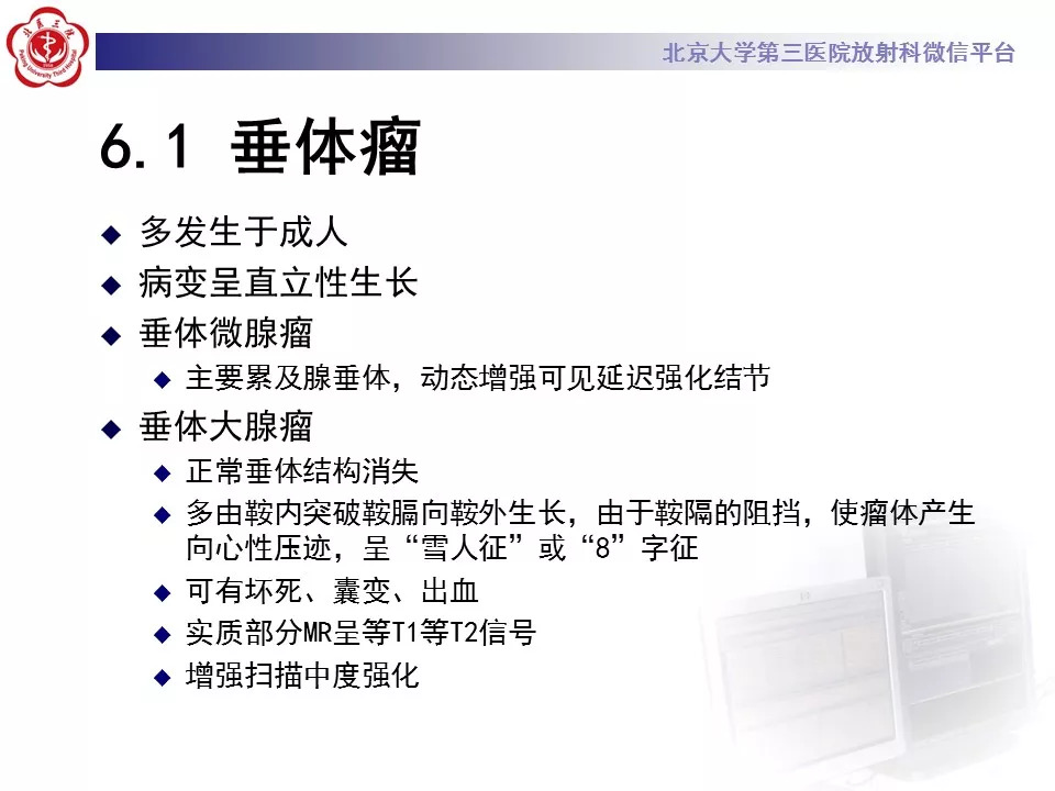 【病例】鞍区生殖细胞瘤1例CT及MR