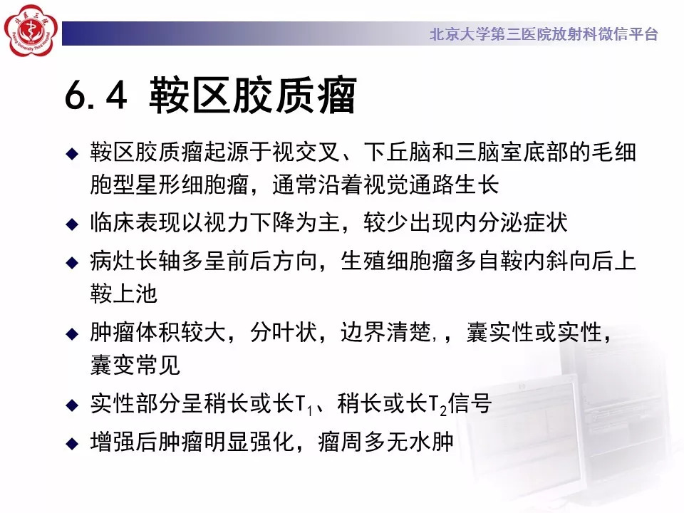 【病例】鞍区生殖细胞瘤1例CT及MR