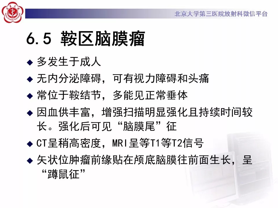 【病例】鞍区生殖细胞瘤1例CT及MR