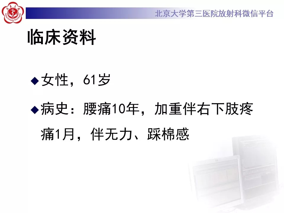 【病例】椎管内硬膜外血管脂肪瘤1例MR
