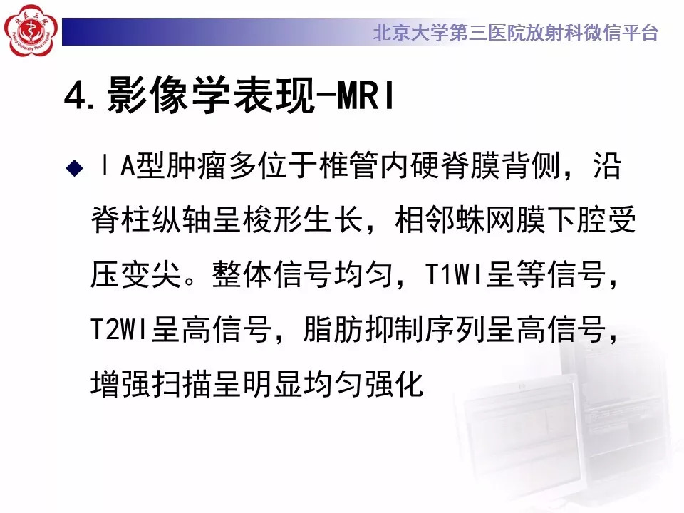 【病例】椎管内硬膜外血管脂肪瘤1例MR