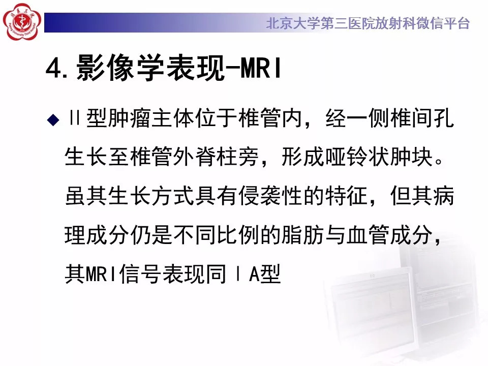 【病例】椎管内硬膜外血管脂肪瘤1例MR