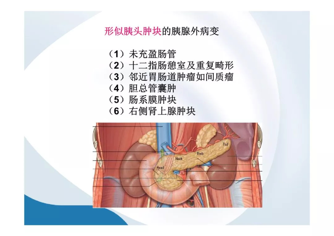 【PPT】胰腺非常见肿瘤影像学检查与诊断思路
