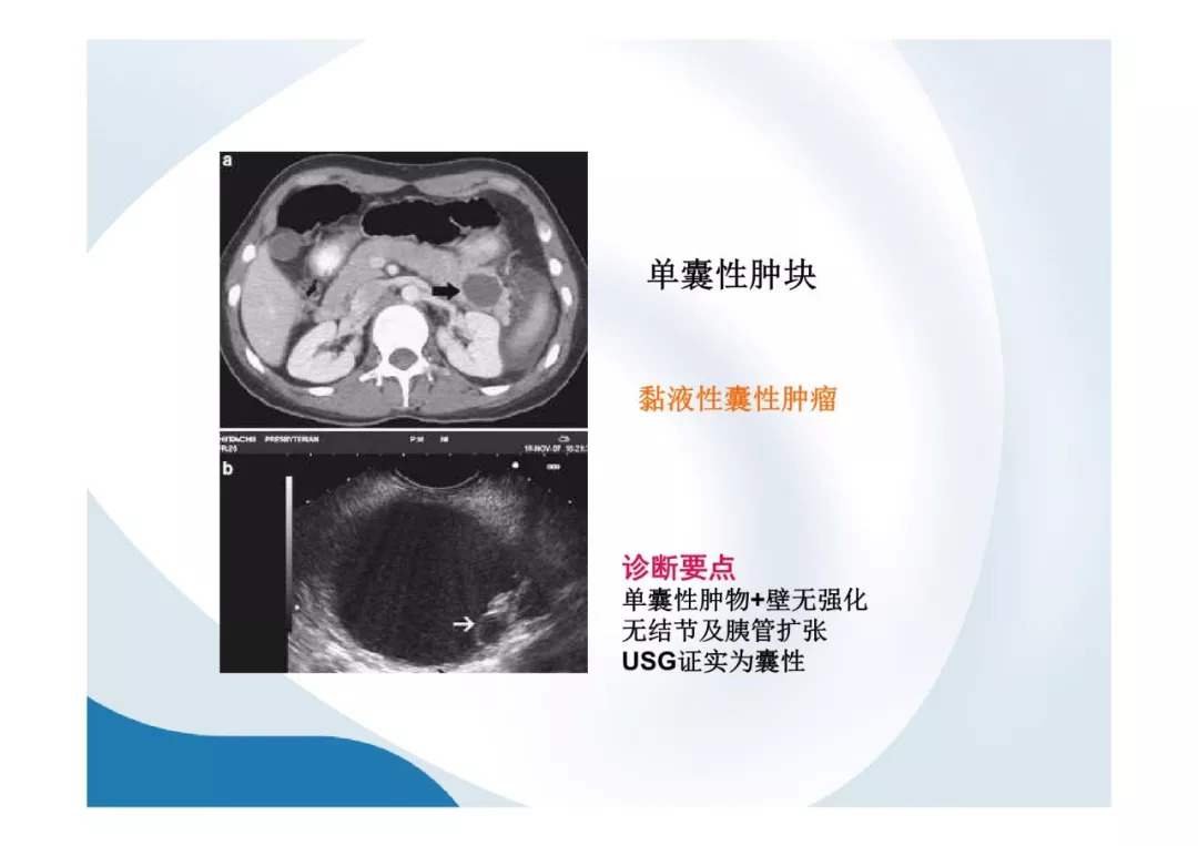 【PPT】胰腺非常见肿瘤影像学检查与诊断思路