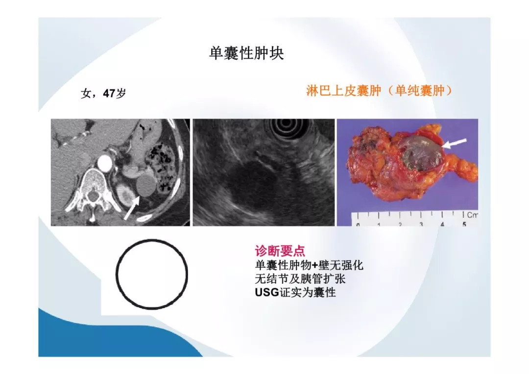【PPT】胰腺非常见肿瘤影像学检查与诊断思路