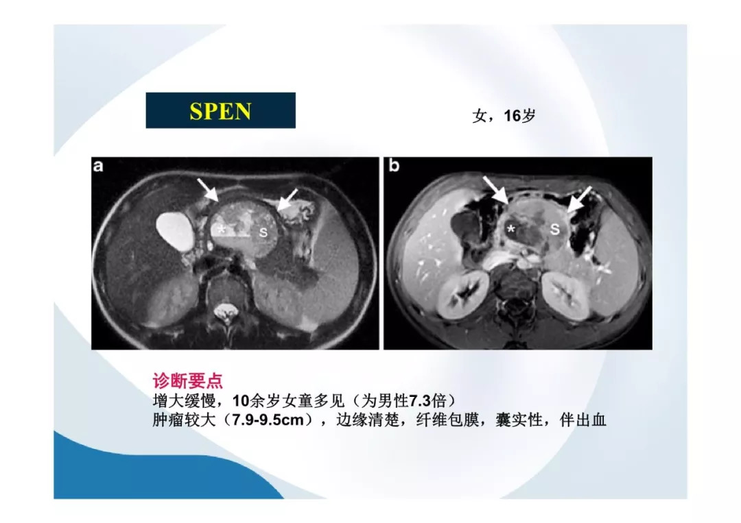 【PPT】胰腺非常见肿瘤影像学检查与诊断思路