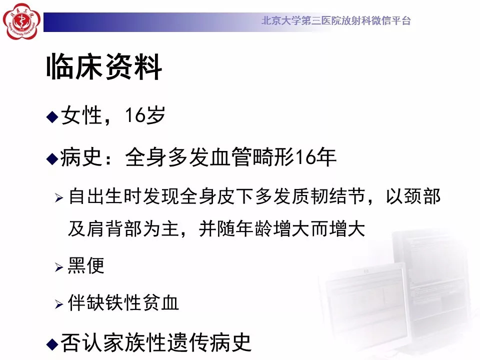 【病例】蓝色橡皮大疱样痣综合征1例CT及MR