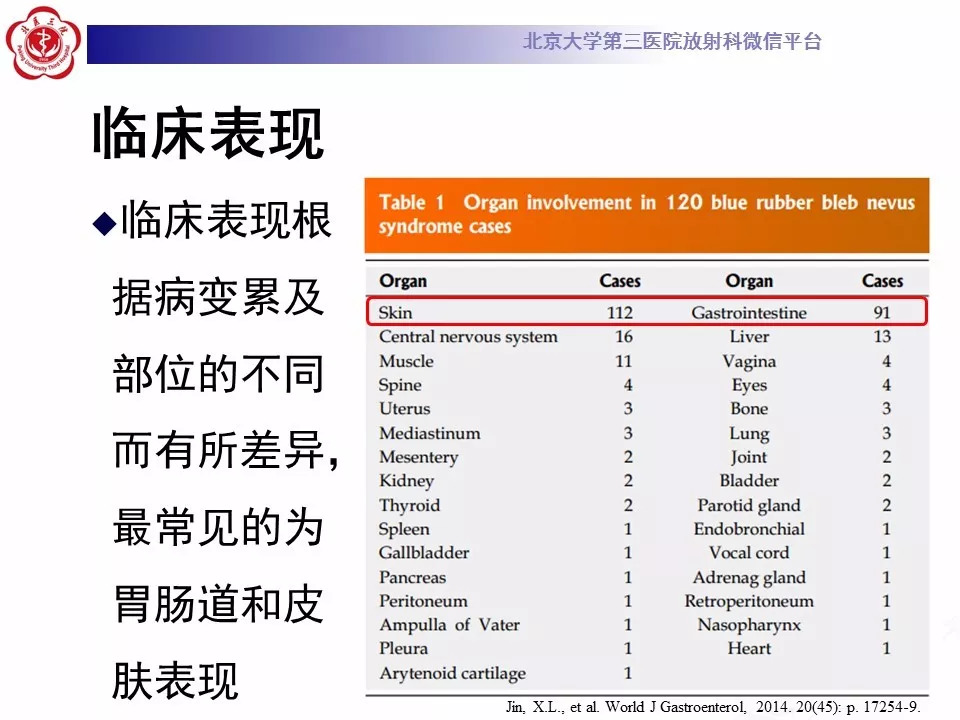 【病例】蓝色橡皮大疱样痣综合征1例CT及MR