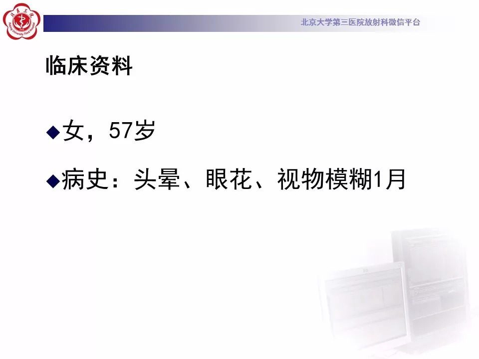 【病例】鞍区脑膜瘤1例CT及MR影像
