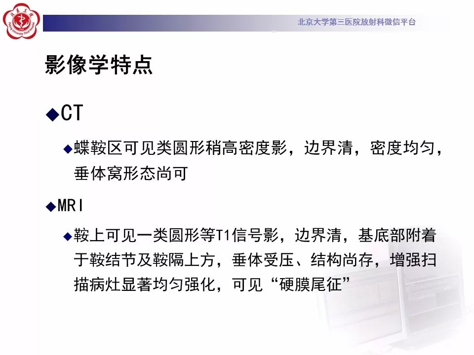 【病例】鞍区脑膜瘤1例CT及MR影像