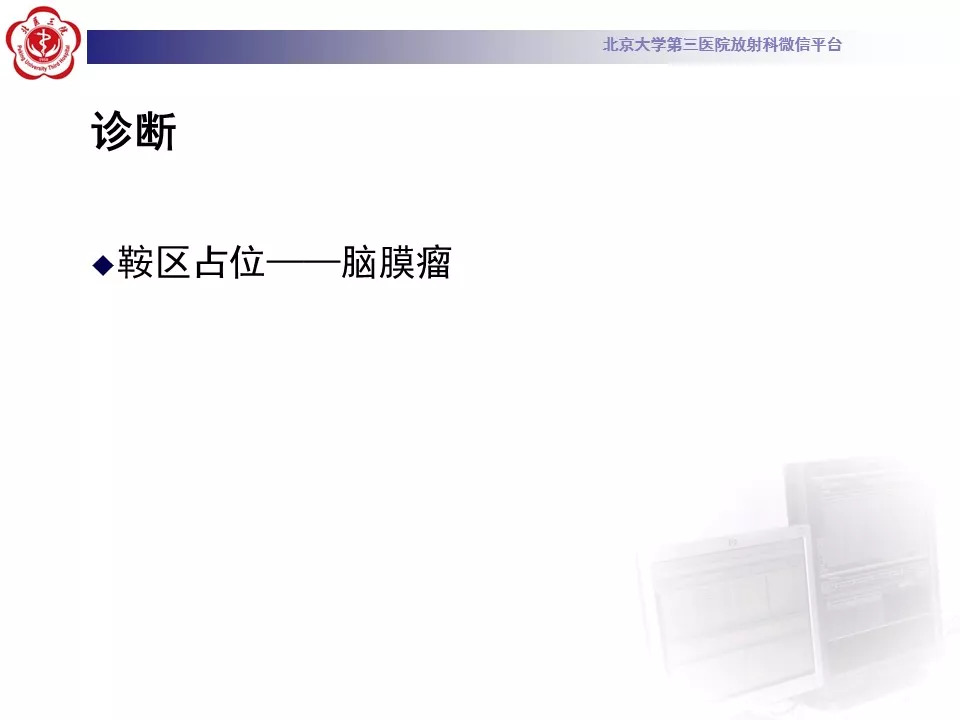 【病例】鞍区脑膜瘤1例CT及MR影像