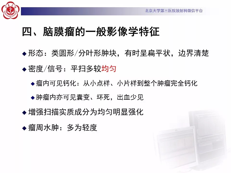 【病例】鞍区脑膜瘤1例CT及MR影像
