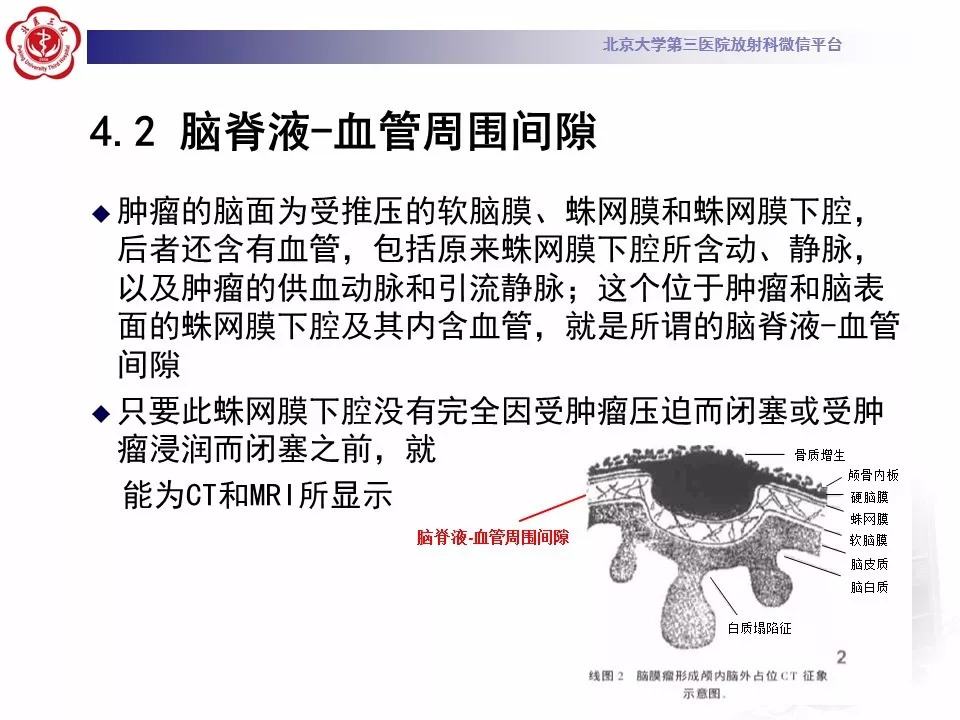 【病例】鞍区脑膜瘤1例CT及MR影像