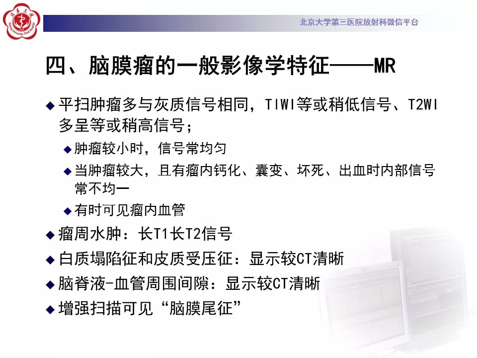 【病例】鞍区脑膜瘤1例CT及MR影像
