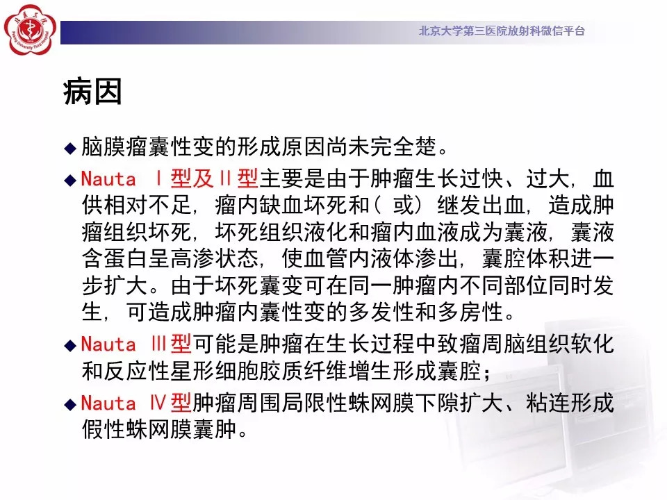 【病例】鞍区脑膜瘤1例CT及MR影像