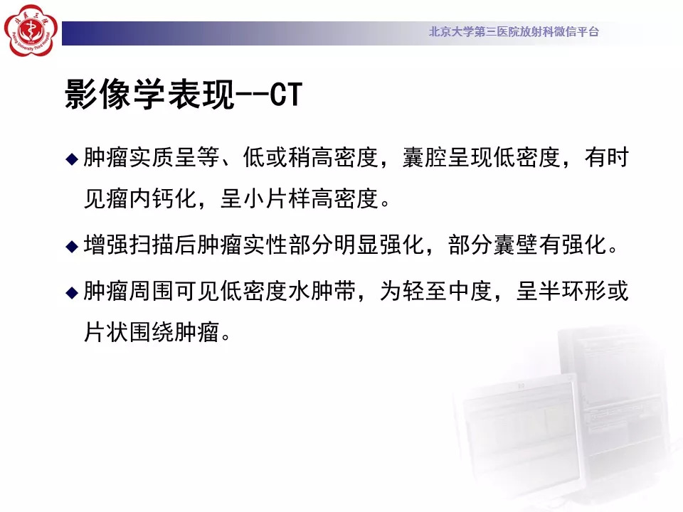 【病例】鞍区脑膜瘤1例CT及MR影像
