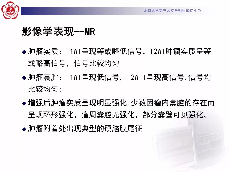 【病例】鞍区脑膜瘤1例CT及MR影像