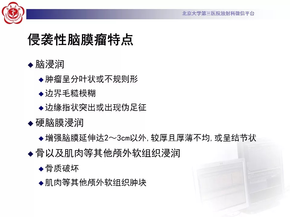 【病例】鞍区脑膜瘤1例CT及MR影像