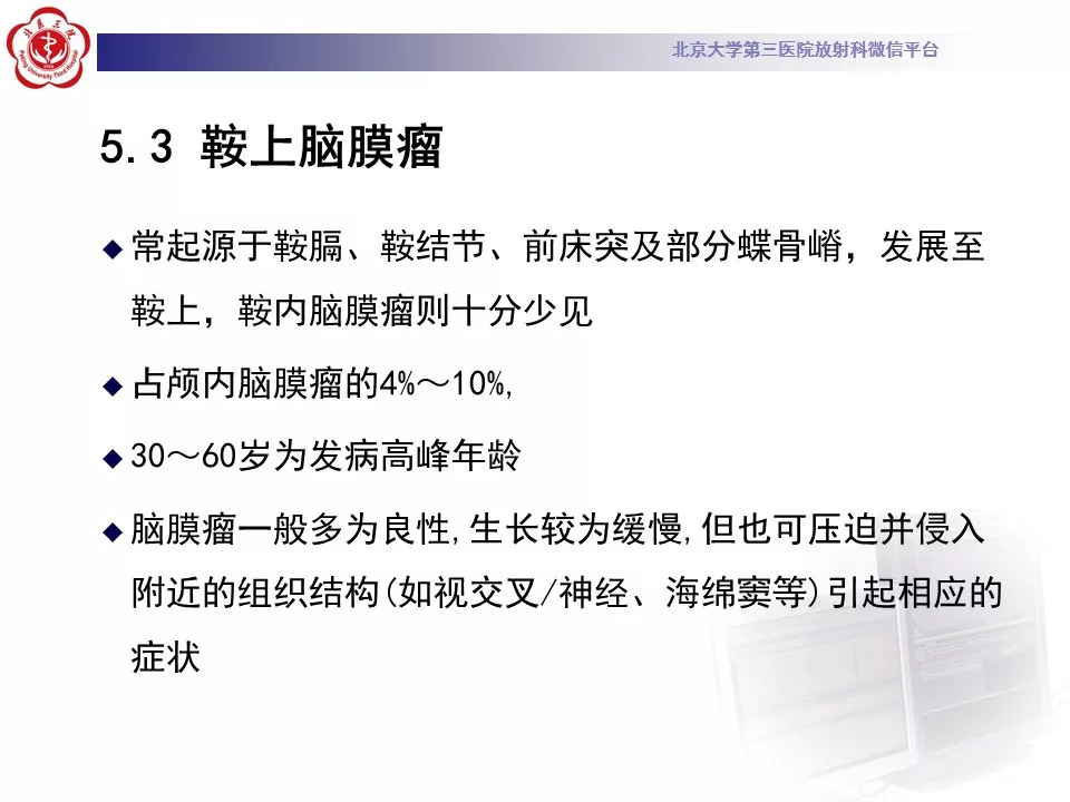 【病例】鞍区脑膜瘤1例CT及MR影像