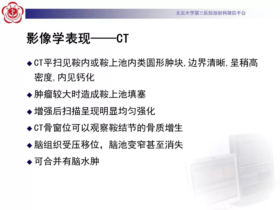 【病例】鞍区脑膜瘤1例CT及MR影像