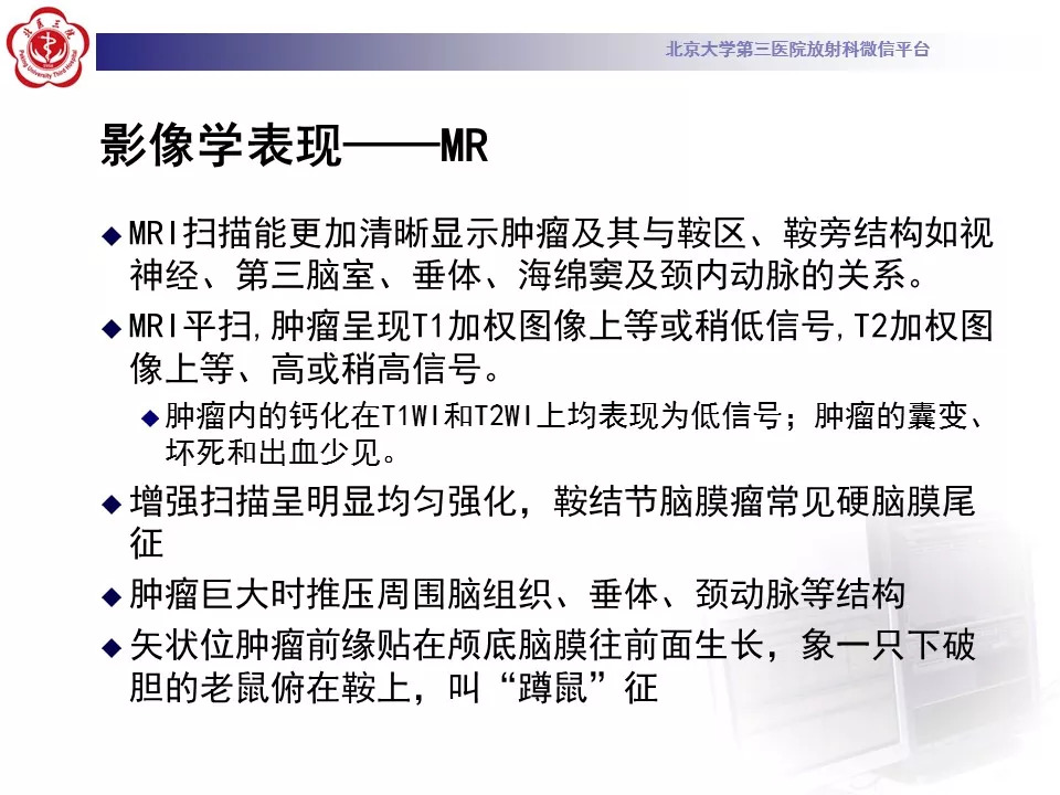 【病例】鞍区脑膜瘤1例CT及MR影像