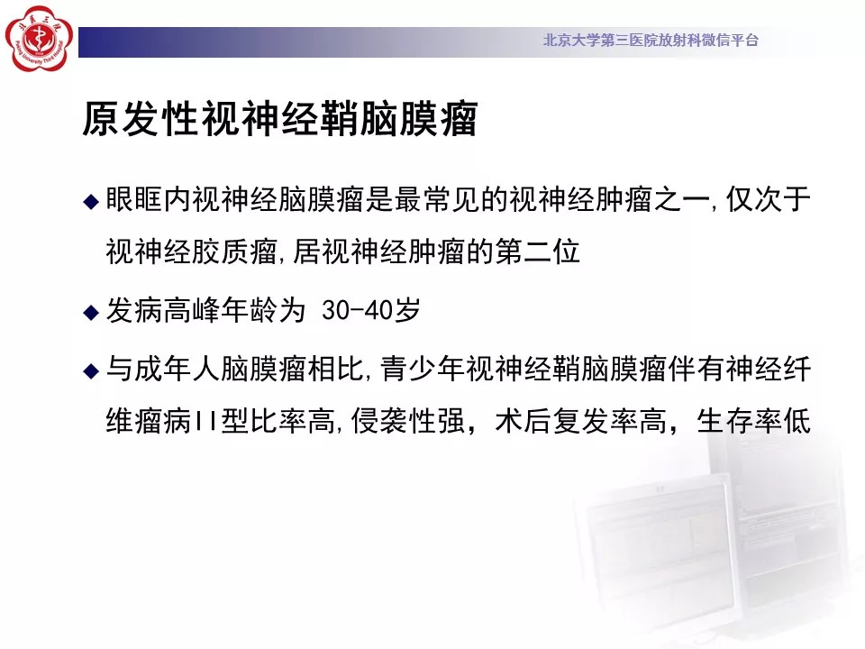 【病例】鞍区脑膜瘤1例CT及MR影像