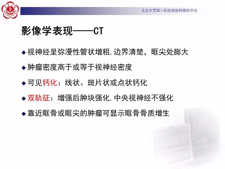 【病例】鞍区脑膜瘤1例CT及MR影像