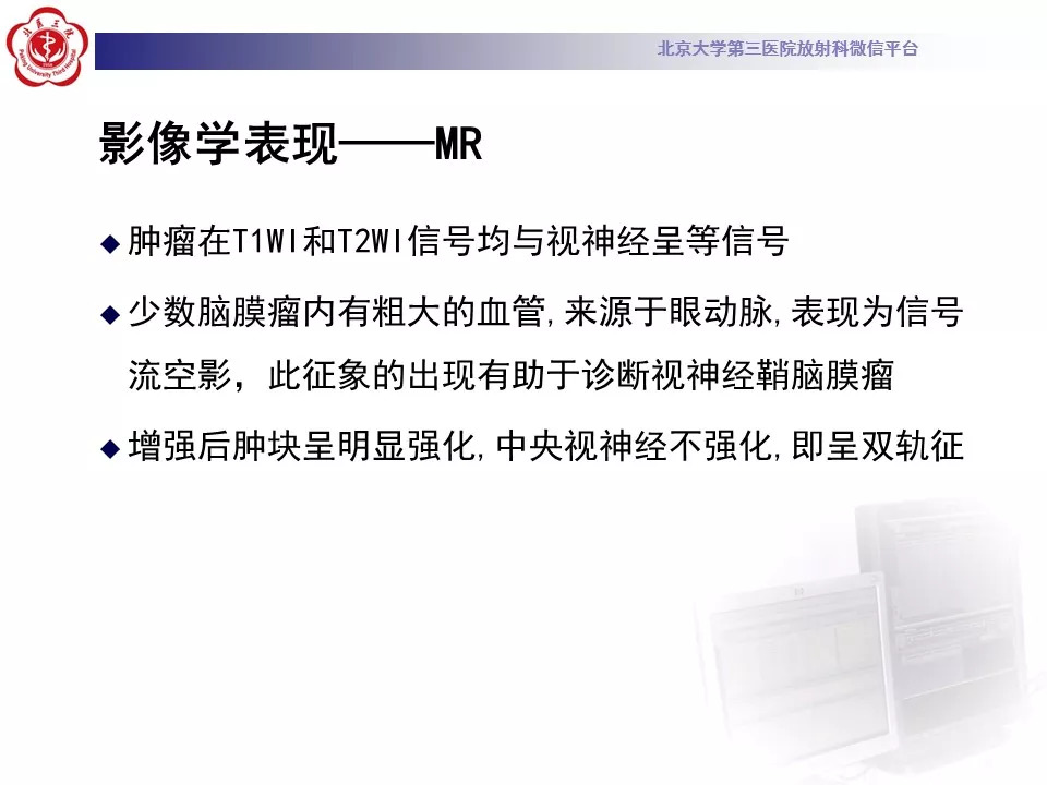 【病例】鞍区脑膜瘤1例CT及MR影像