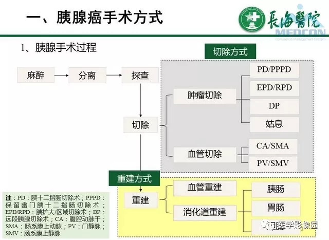 【PPT】胰胰腺癌术前影像评估及规范化报告