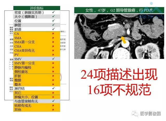 【PPT】胰胰腺癌术前影像评估及规范化报告