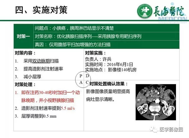 【PPT】胰胰腺癌术前影像评估及规范化报告
