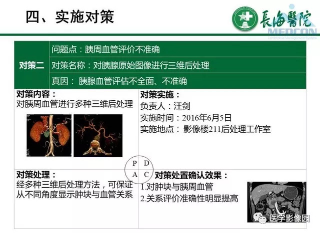 【PPT】胰胰腺癌术前影像评估及规范化报告