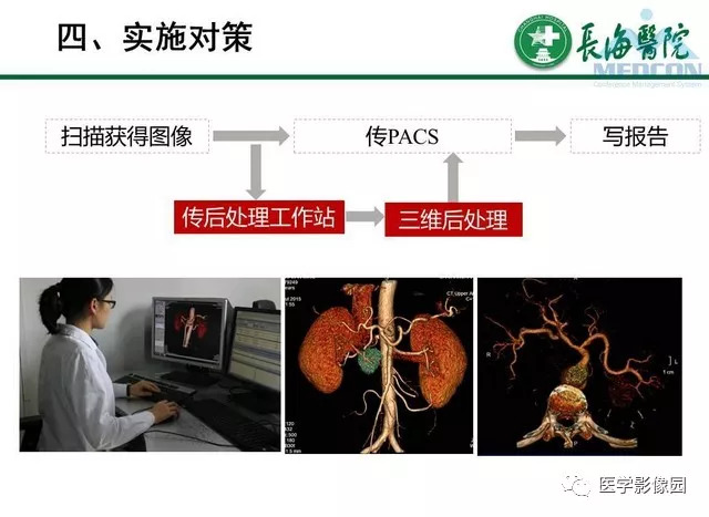 【PPT】胰胰腺癌术前影像评估及规范化报告