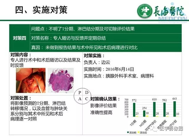 【PPT】胰胰腺癌术前影像评估及规范化报告