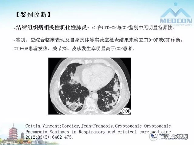 【PPT】隐源性机化性肺炎的影像学特点