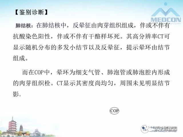 【PPT】隐源性机化性肺炎的影像学特点