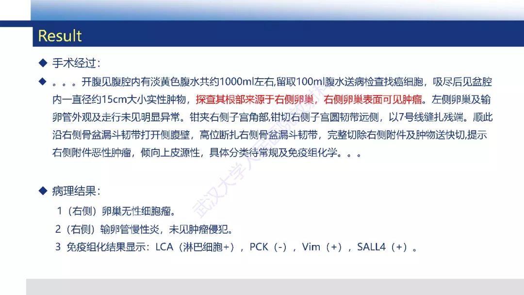 【PPT】卵巢无性细胞瘤影像诊断
