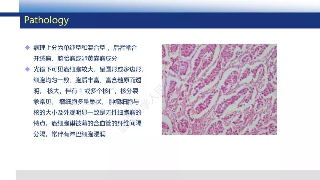 【PPT】卵巢无性细胞瘤影像诊断