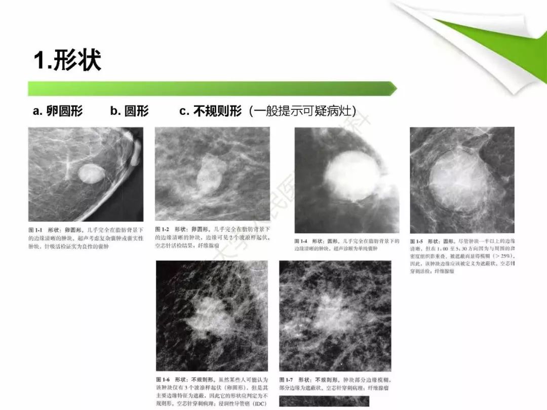 【PPT】乳腺X线影像表现与术语规范