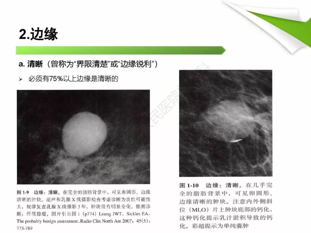 【PPT】乳腺X线影像表现与术语规范