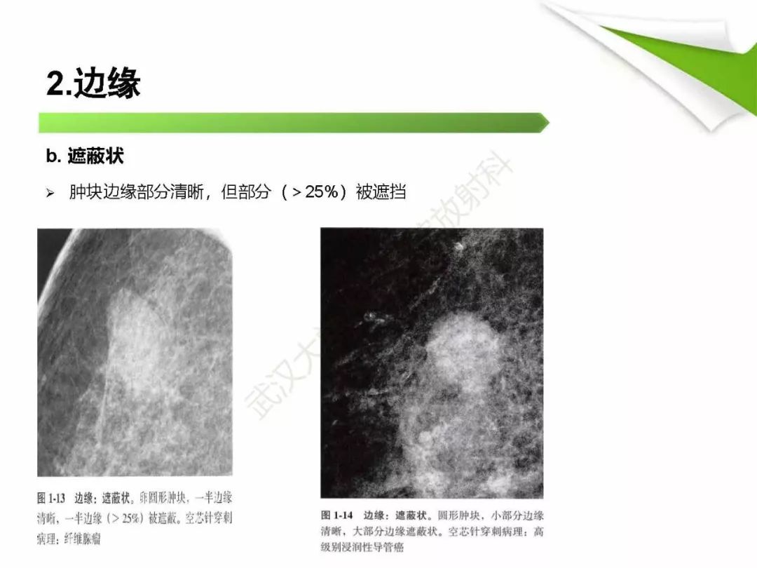 【PPT】乳腺X线影像表现与术语规范
