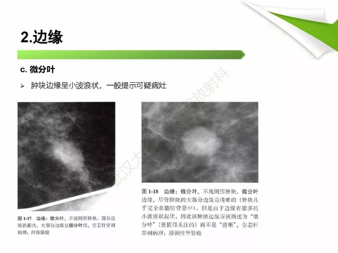 【PPT】乳腺X线影像表现与术语规范