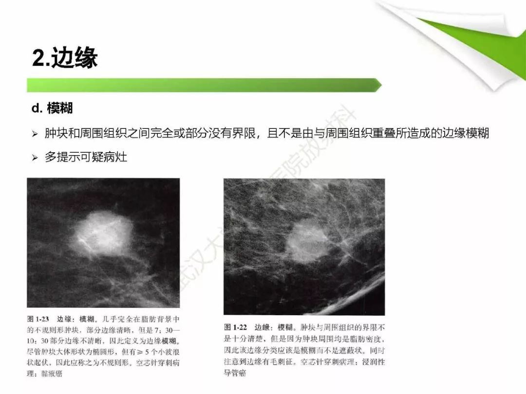 【PPT】乳腺X线影像表现与术语规范