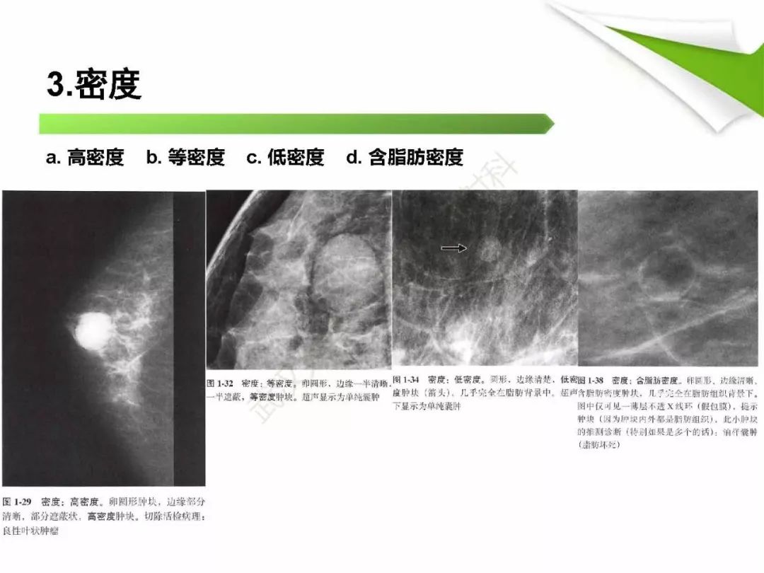 【PPT】乳腺X线影像表现与术语规范