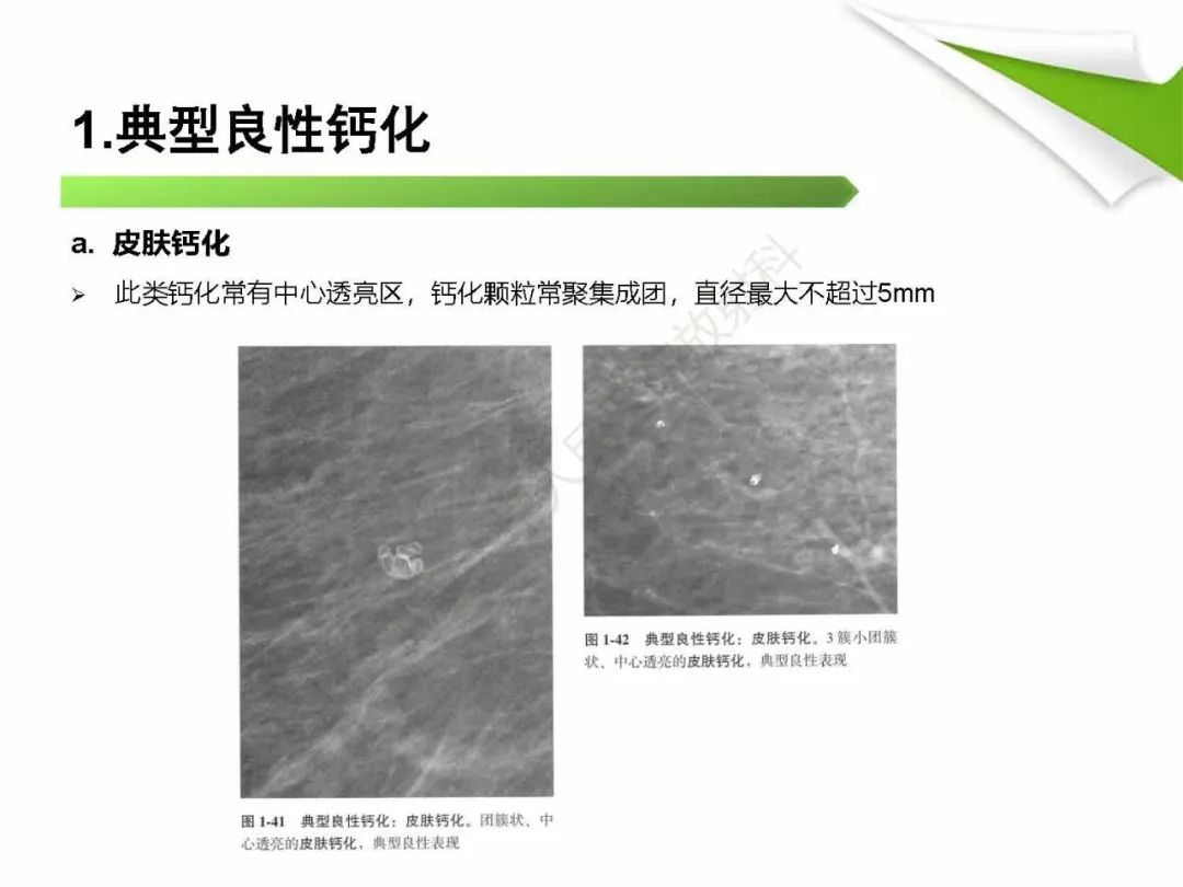 【PPT】乳腺X线影像表现与术语规范