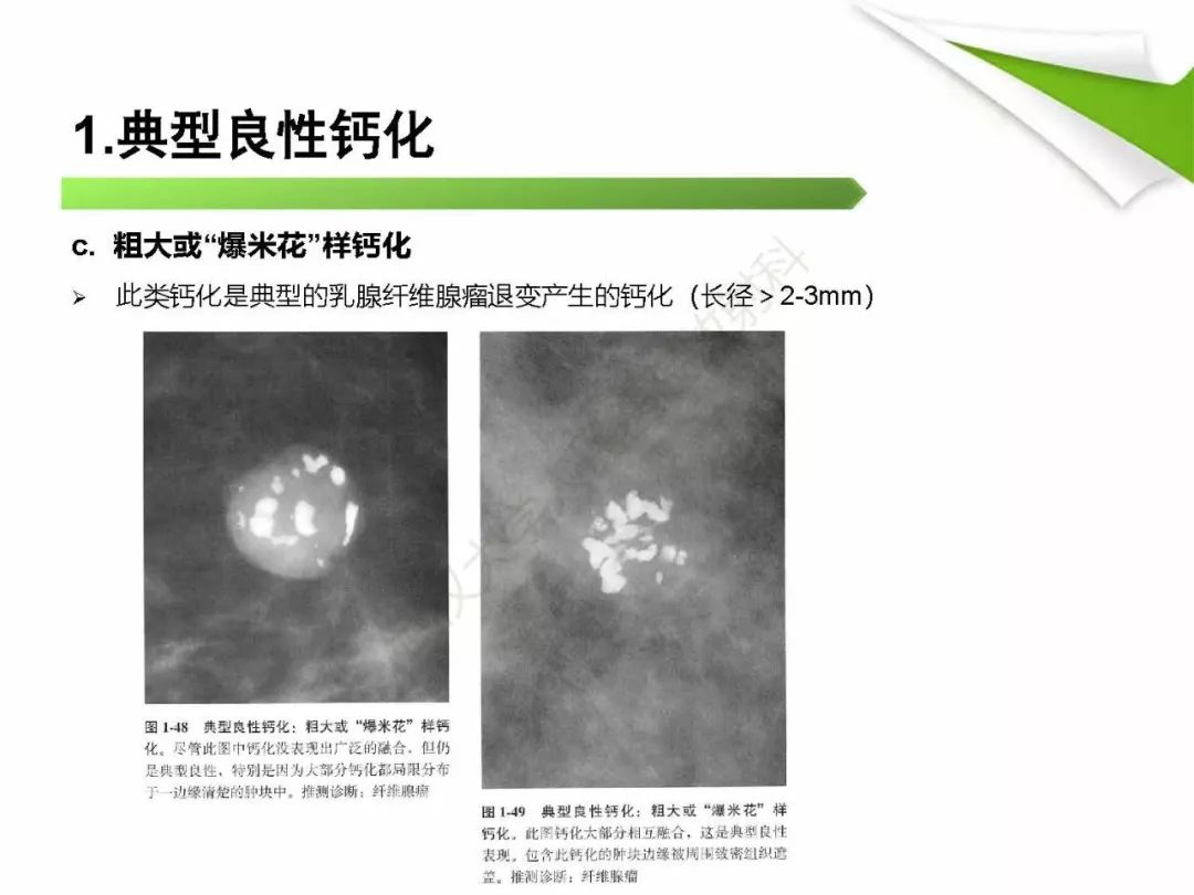 【PPT】乳腺X线影像表现与术语规范
