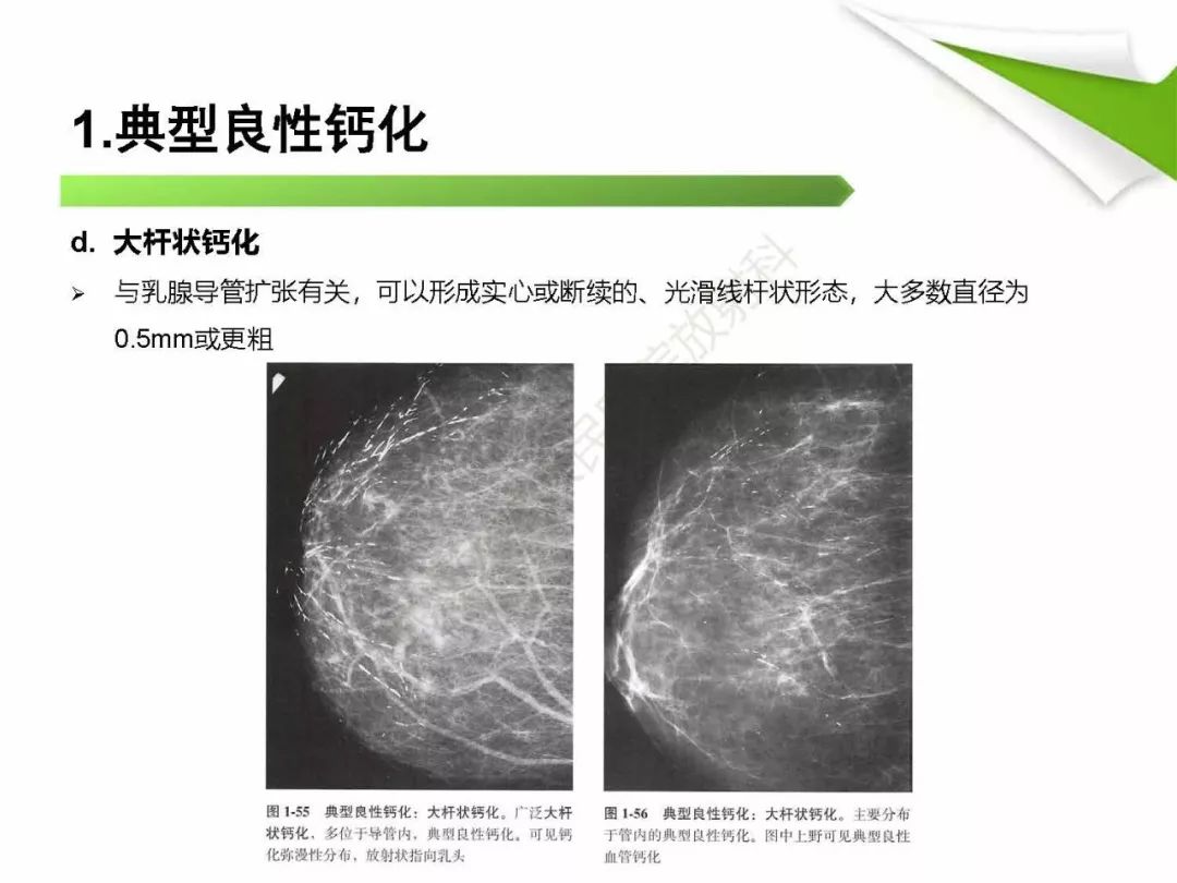 【PPT】乳腺X线影像表现与术语规范